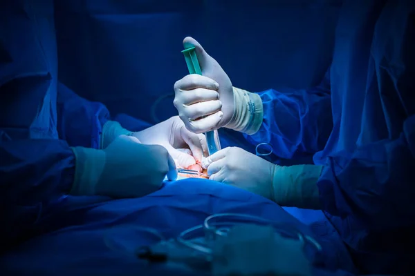 Surgery Modern Hospital Being Performed Team Professionals Shallow Dof Color — Stock Photo, Image