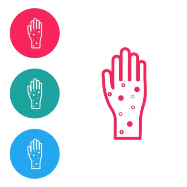 Beyaz arka planda sedef ya da egzama ikonu olan kırmızı çizgili El. Alerjene veya kronik vücut sorununa karşı insan derisi tepkisi kavramı. Simgeleri daire düğmelerine ayır. Vektör İllüstrasyonu