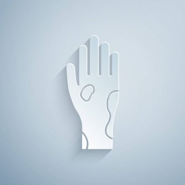 Sedef hastalığı ya da egzama ikonlu kağıt kesiği gri arka planda. Alerjene veya kronik vücut sorununa karşı insan derisi tepkisi kavramı. Kağıt sanatı tarzı. Vektör İllüstrasyonu