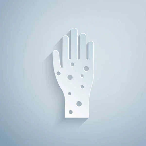 Разрезанная бумага Рука с псориазом или иконой экземы изолирована на сером фоне. Концепция реакции кожи человека на аллерген или хроническую проблему организма. Бумажный стиль. Векторная миграция — стоковый вектор
