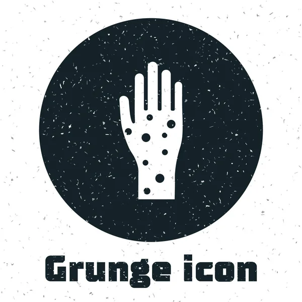 Grunge Hand med psoriasis eller eksem ikon isolerad på vit bakgrund. Begreppet mänsklig hudrespons på allergen eller kroniska kroppsproblem. Vektor Illustration — Stock vektor