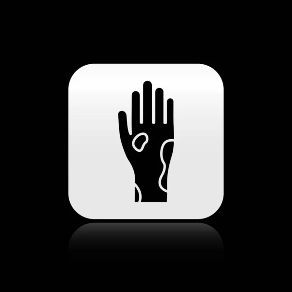 Mão Negra com psoríase ou ícone de eczema isolado em fundo preto. Conceito de resposta da pele humana ao alérgeno ou problema crônico do corpo. Botão quadrado de prata. Ilustração vetorial — Vetor de Stock