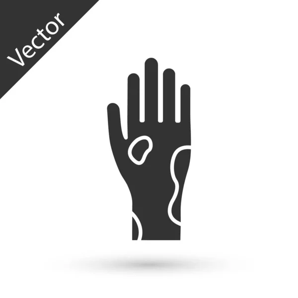 Mano gris con psoriasis o icono de eczema aislado sobre fondo blanco. Concepto de respuesta de la piel humana al alérgeno o al problema crónico del cuerpo. Ilustración vectorial — Vector de stock