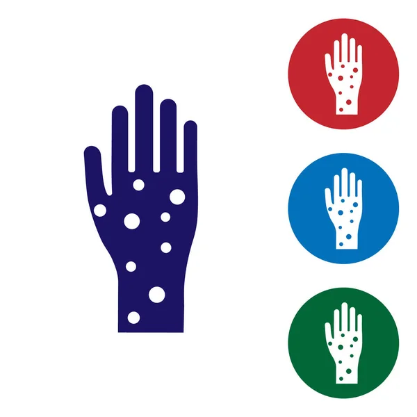 Main bleue avec psoriasis ou icône eczéma isolé sur fond blanc. Concept de réponse cutanée humaine à un allergène ou à un problème chronique du corps. Définir des icônes de couleur dans les boutons cercle. Illustration vectorielle — Image vectorielle