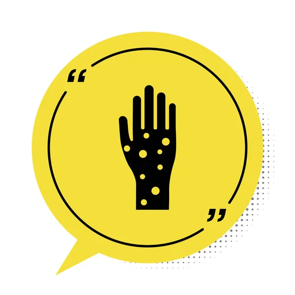 Black Hand with psoriasis or eczema icon isolated on white background. Concept of human skin response to allergen or chronic body problem. Yellow speech bubble symbol. Vector Illustration — 스톡 벡터