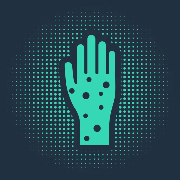Grön Hand med psoriasis eller eksem ikon isolerad på blå bakgrund. Begreppet mänsklig hudrespons på allergen eller kroniska kroppsproblem. Abstrakt cirkel slumpmässiga prickar. Vektor Illustration — Stock vektor