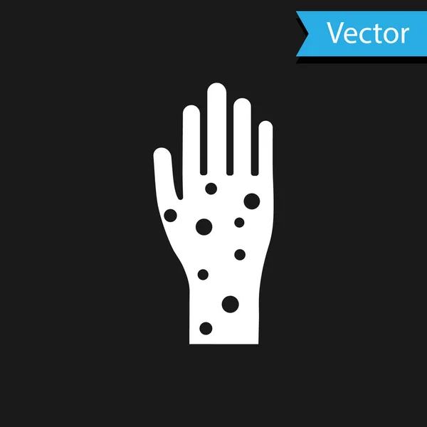 Weiße Hand mit Schuppenflechte oder Ekzem-Symbol auf schwarzem Hintergrund. Konzept der menschlichen Hautreaktion auf Allergene oder chronische Körperprobleme. Vektorillustration — Stockvektor