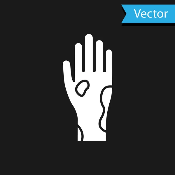 Белая рука с псориазом или иконой экземы изолированы на черном фоне. Концепция реакции кожи человека на аллерген или хроническую проблему организма. Векторная миграция — стоковый вектор