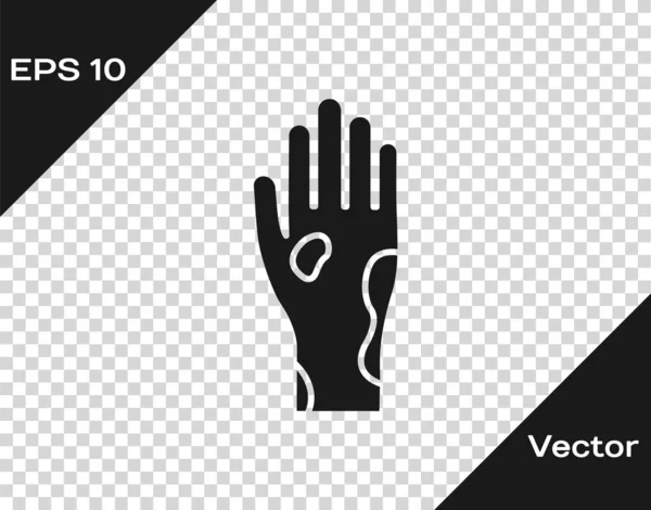 透明な背景に隔離された乾癬または湿疹のアイコンを持つ灰色の手。アレルゲンや慢性的な体の問題に対する人間の皮膚応答の概念.ベクターイラスト — ストックベクタ