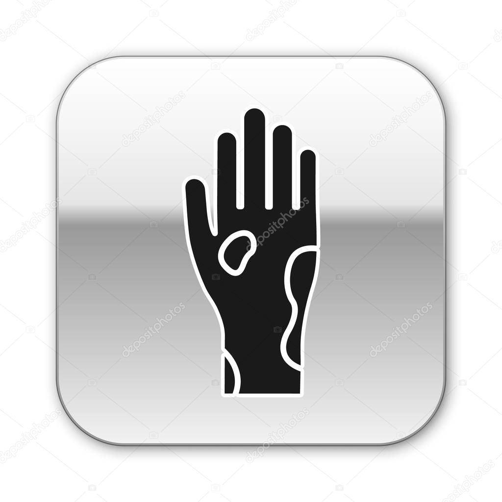 Black Hand with psoriasis or eczema icon isolated on white background. Concept of human skin response to allergen or chronic body problem. Silver square button. Vector Illustration