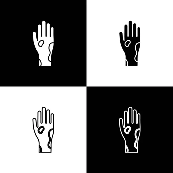 Set Mano con icono de psoriasis o eczema aislado sobre fondo blanco y negro. Concepto de respuesta de la piel humana al alérgeno o al problema crónico del cuerpo. Ilustración vectorial — Archivo Imágenes Vectoriales