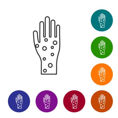 Beyaz arka planda sedef ya da egzama ikonu olan gri çizgili El. Alerjene veya kronik vücut sorununa karşı insan derisi tepkisi kavramı. Simgeleri renk daire düğmelerine ayarla. Vektör İllüstrasyonu