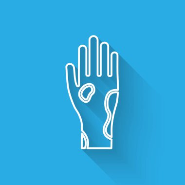 Sedef hastalığı ya da egzama ikonu olan beyaz çizgili El uzun gölgeli. Alerjene veya kronik vücut sorununa karşı insan derisi tepkisi kavramı. Vektör İllüstrasyonu