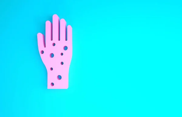 Розовая рука с псориазом или иконой экземы изолированы на синем фоне. Концепция реакции кожи человека на аллерген или хроническую проблему организма. Концепция минимализма. 3D-рендеринг — стоковое фото