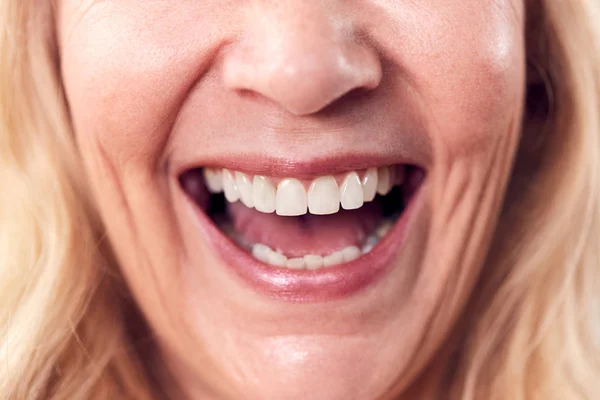 Close Up Of Mouth Of Laughing Mature Woman In Studio
