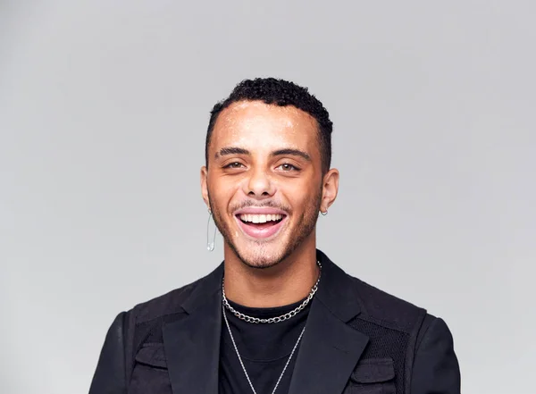 Studio Portrait Jeune Homme Avec Trouble Pigmentation Peau Souriant Caméra — Photo