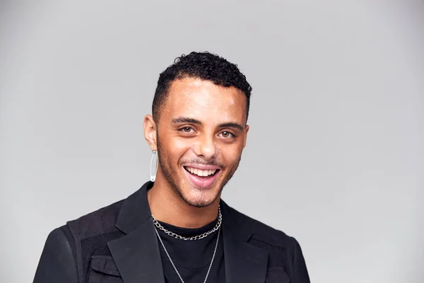 Studio Portrait Jeune Homme Avec Trouble Pigmentation Peau Souriant Caméra — Photo