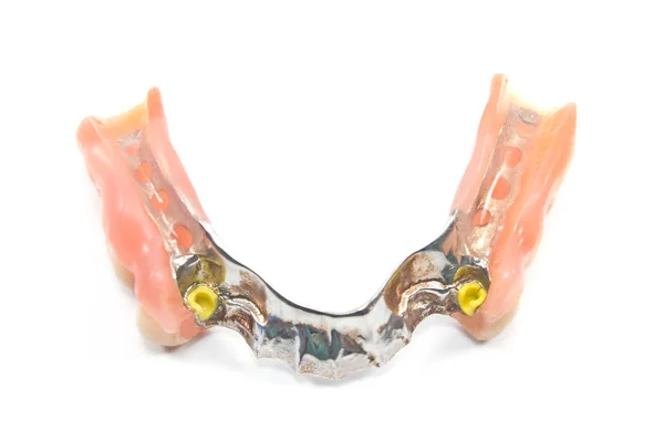 Partial denture bottom side - dental prosthetics isolated on whi — Stock Photo, Image