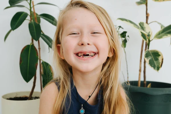 Mudança Natural Dentes Menino Anos Idade Com Longos Cabelos Loiros — Fotografia de Stock