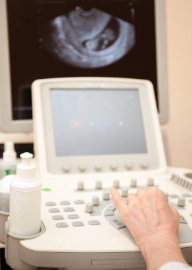 Doktor ultrason sınava gerçekleştirme