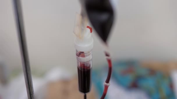 Krankenhaus, ein Tropf mit Blut. — Stockvideo