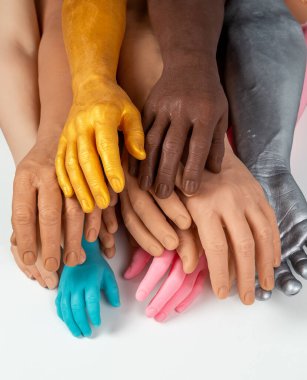 Farklı boylarda ve renklerde silikon protez eller, kişi için tıbbî parlaklık implantları.