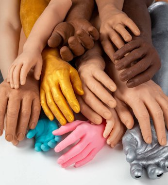 Farklı boylarda ve renklerde silikon protez eller, kişi için tıbbî parlaklık implantları.