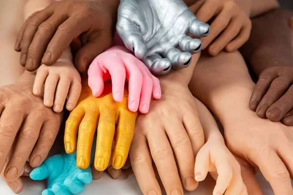 Siliconen Prothetische Handen Van Verschillende Kleuren Maten Geneeskunde Briht Implantaten — Stockfoto