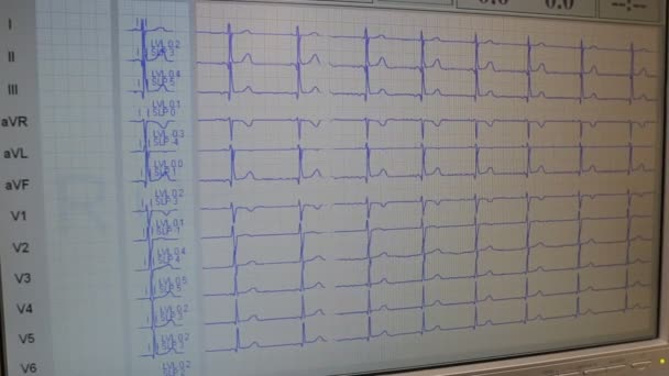 Nucleaire cardiale stresstest — Stockvideo