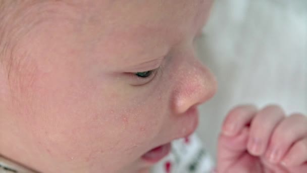 Hormonální vyrážky v Nose ruce novorozenců