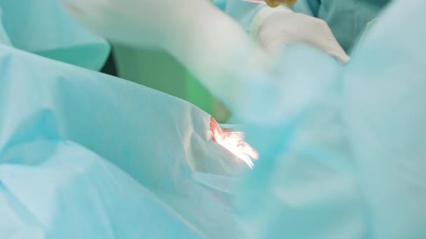 Χειρουργοί Ophtalmology εντός της παρέμβασης — Αρχείο Βίντεο