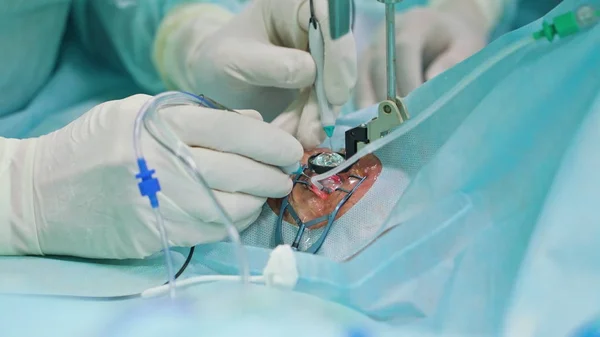Oftalmologi kirurger inom ingripande — Stockfoto
