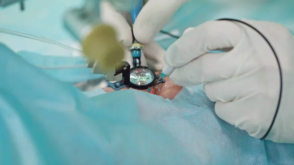 Oftalmologie chirurgen binnen de interventie — Stockfoto