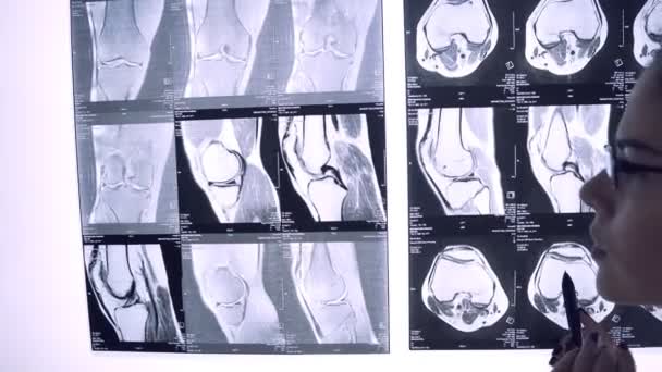 El médico mira a través de la radiografía de las articulaciones. Instantánea de la resonancia magnética de las articulaciones — Vídeo de stock