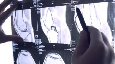 Doktor eklemlerin röntgenlerine bakıyor. Eklemlerin MR 'ının görüntüsü