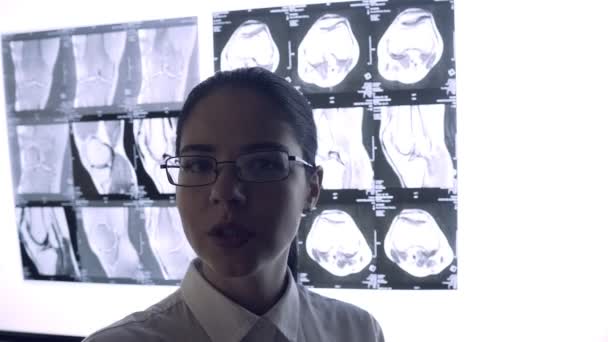 De dokter kijkt door de röntgenfoto van de gewrichten. Snapshot van de MRI van de gewrichten — Stockvideo