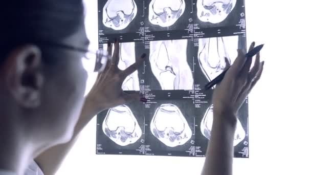 Le médecin regarde à travers la radiographie des articulations. Instantané de l'IRM des articulations — Video