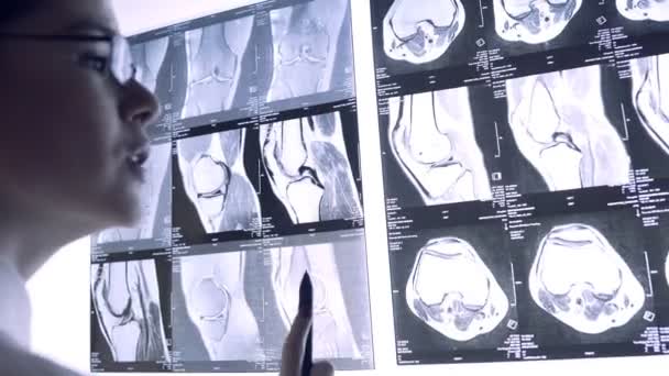 Le médecin regarde à travers la radiographie des articulations. Instantané de l'IRM des articulations — Video