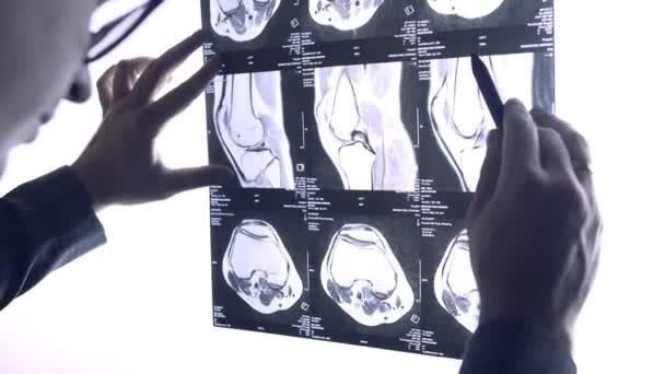 El médico mira a través de la radiografía de las articulaciones. Instantánea de la resonancia magnética de las articulaciones — Vídeo de stock