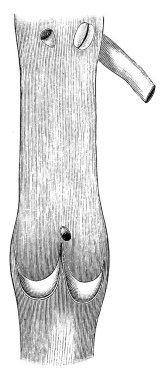 Damarın içine yerleştirilmiş bir valf figürü, kanın yanlış yöne gitmesini engellemek için, klasik çizgi çizimi ya da oyma çizimi.