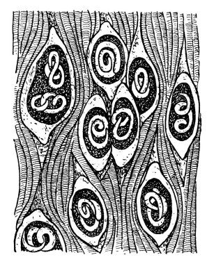 Kas içindeki trichinae 'nin tipik bir temsili, kapsüllü. Domuz kaslarının, klasik çizimlerin ya da gravür resimlerinin olduğu bir gramofonda 12.000 tane olabilir..