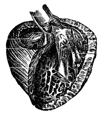 Ön duvarları söktükten sonra sol ventrikülün dörtte üçlük görüntüsü, içinde üç kalp resmi gösteriyor, eski model çizimler veya oymalar. 