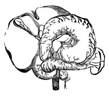 Abdominal organların atardamarları, karın organlarındaki atardamarların üç farklı görüntüsünü gösteriyor. Abdominal organların atardamarları, vintage çizim veya oymacılık. 