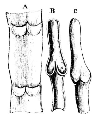 Etiketler: A, damarın bir parçası iki çift kapakçık ile açılır ve yayılır; B, bir damarın boylamsal bölümü; C, şişmiş bir damar, vintage çizgi çizimi veya resimleme bölümü.
