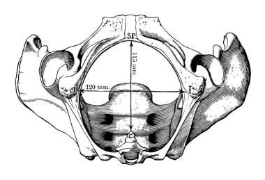 Bu resimde pelvik çıkış, vintage çizgi çizme veya oyma illüstrasyon temsil eder..