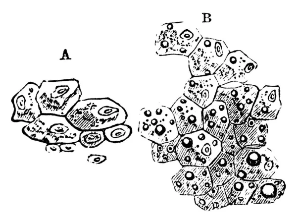 ヴィンテージライン図面や彫刻イラストの様々なサイズの粒子を含む肝細胞 ラベル付き 肝細胞とB 肝細胞の典型的な表現 — ストックベクタ
