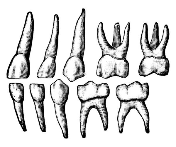 仮歯は 一次歯や乳歯とも呼ばれ 人間の成長 ヴィンテージラインの描画や彫刻のイラストで歯の最初のセットです — ストックベクタ