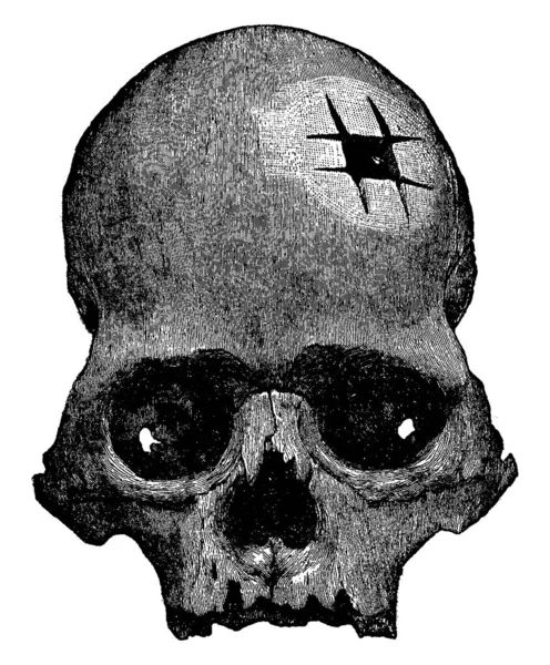 Esta Ilustración Representa Cráneo Inca Dibujo Línea Vintage Ilustración Grabado — Archivo Imágenes Vectoriales