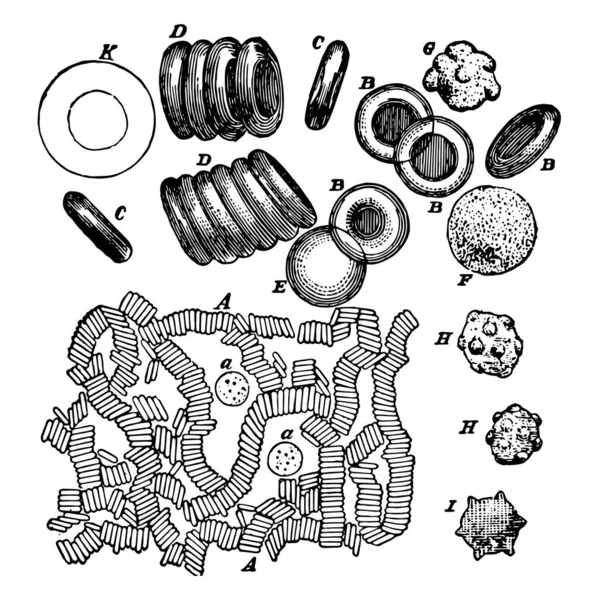 ขาว Corpuscle กษาด วยกรดอะซ กและส แดง Corpuscles รอยย นหร Crenated — ภาพเวกเตอร์สต็อก