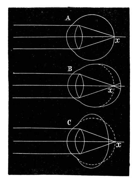 Cette Illustration Représente Vision Dessin Ligne Vintage Illustration Gravure — Image vectorielle